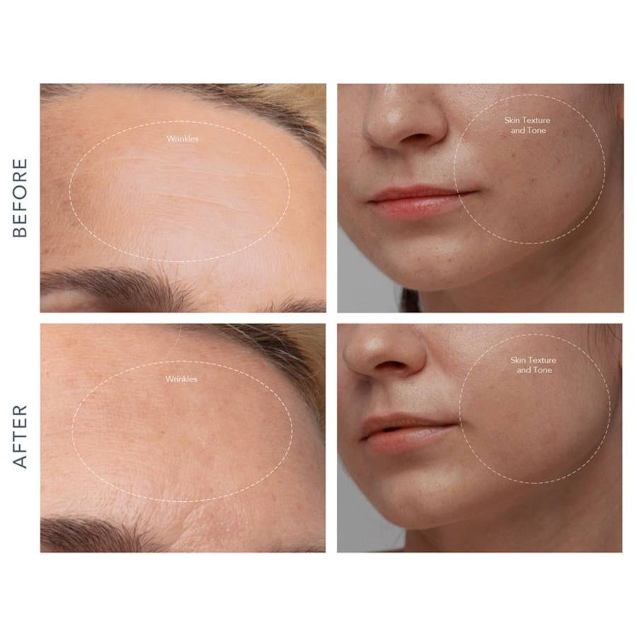 Foreo Reinigungsprodukte Sonderangebote