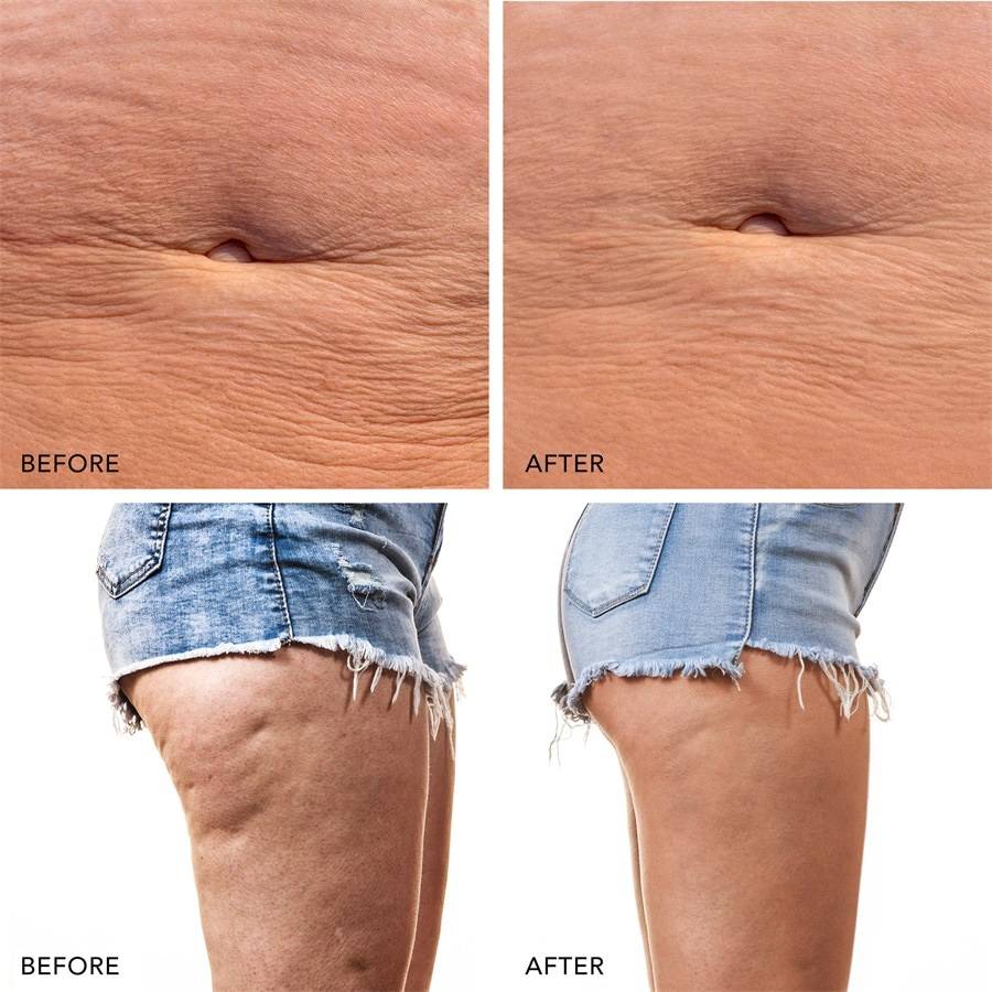 Foreo Body Super Rabatt