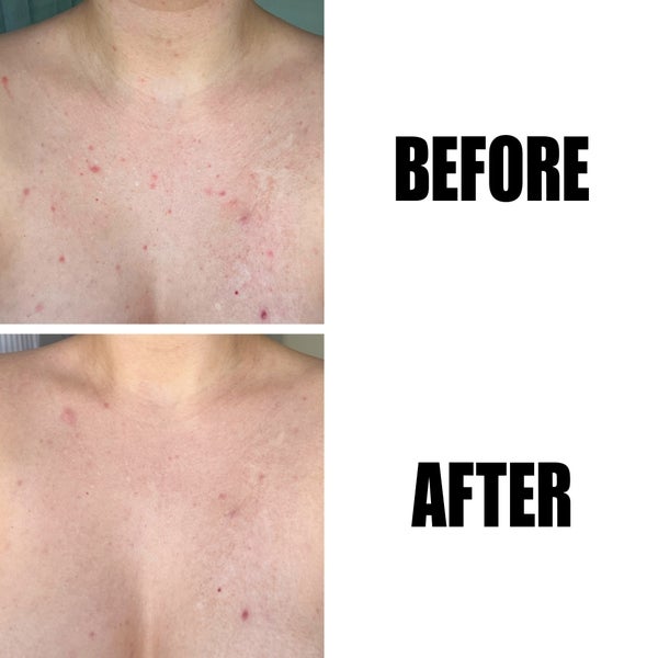 The INKEY List Glycolic Acid Exfoliating Body Stick 45g Letzte 3 Tage