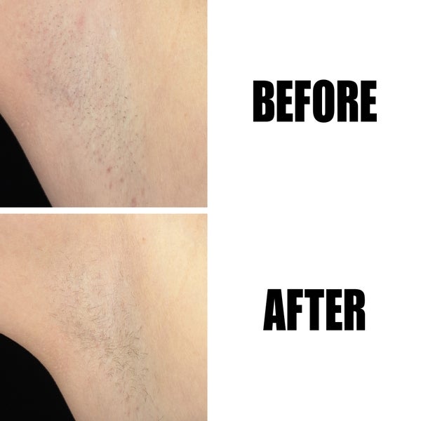 The INKEY List Glycolic Acid Exfoliating Body Stick 45g Letzte 3 Tage