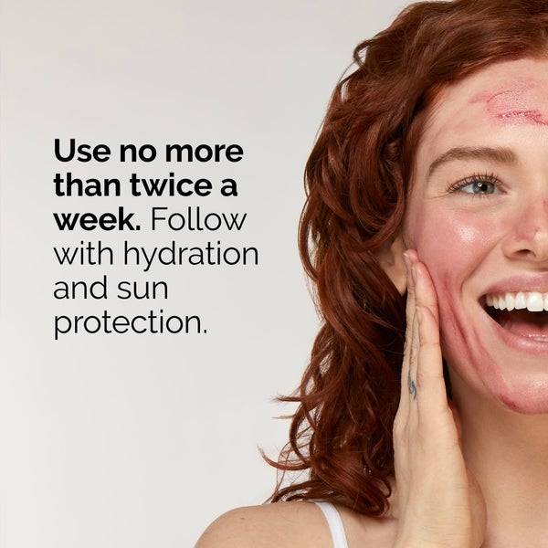 The Ordinary AHA 30% + BHA 2% Peeling Solution 30ml Lagerräumung