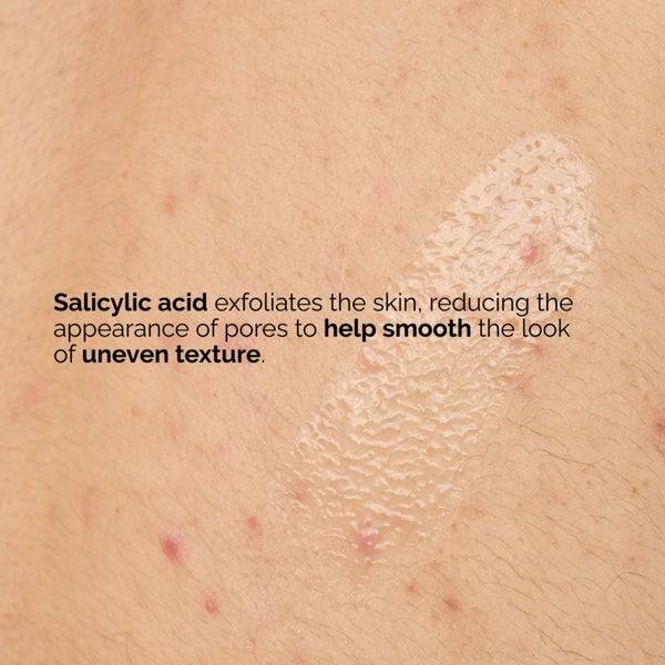 The Ordinary Salicylic Acid 0.5% Body Serum 240ml Super Sparpreis