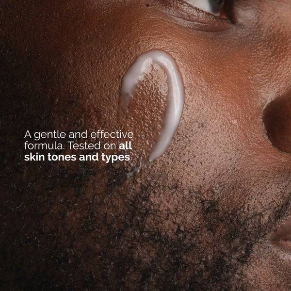 The Ordinary Niacinamide 5% Face and Body Emulsion 100ml Kostenlose Rückgabe