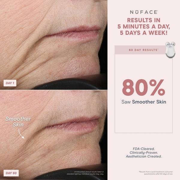 NuFACE® Mini Starter Kit Bis zu 50% Rabatt