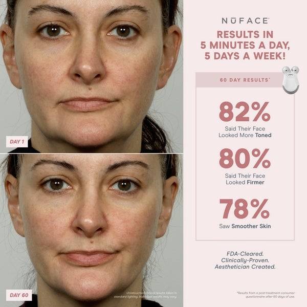 NuFACE® Mini Starter Kit Bis zu 50% Rabatt