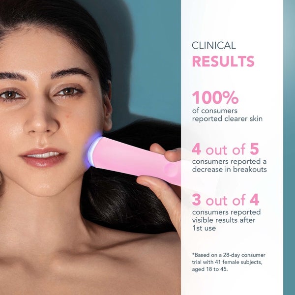 FOREO ESPADA 2 Device - Pearl Pink 50% Rabatt mit kostenlosem Versand