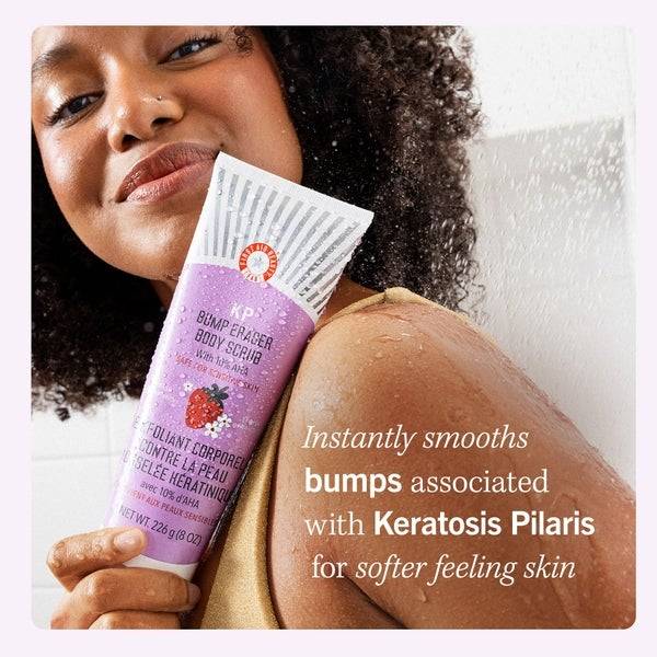 First Aid Beauty KP Bump Eraser Fresh Strawberry Body Scrub with 10% AHA 226g Blitzverkäufe