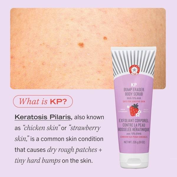 First Aid Beauty KP Bump Eraser Fresh Strawberry Body Scrub with 10% AHA 226g Blitzverkäufe