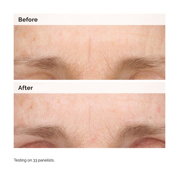 The Ordinary Retinal 0.2% Emulsion 15ml Auslauf