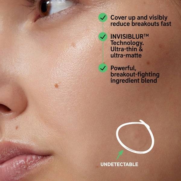The INKEY List Hydrocolloid Invisible Pimple Patches Limitierter Zeitrabatt