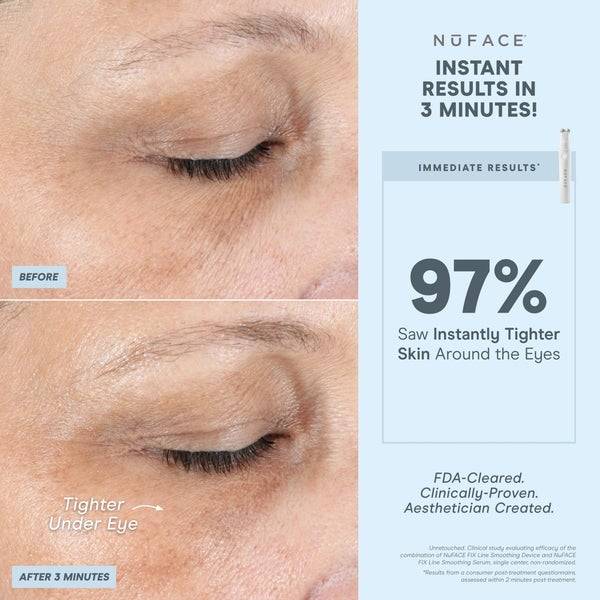 NuFACE FIX Line Smoothing Device Fabrikladen