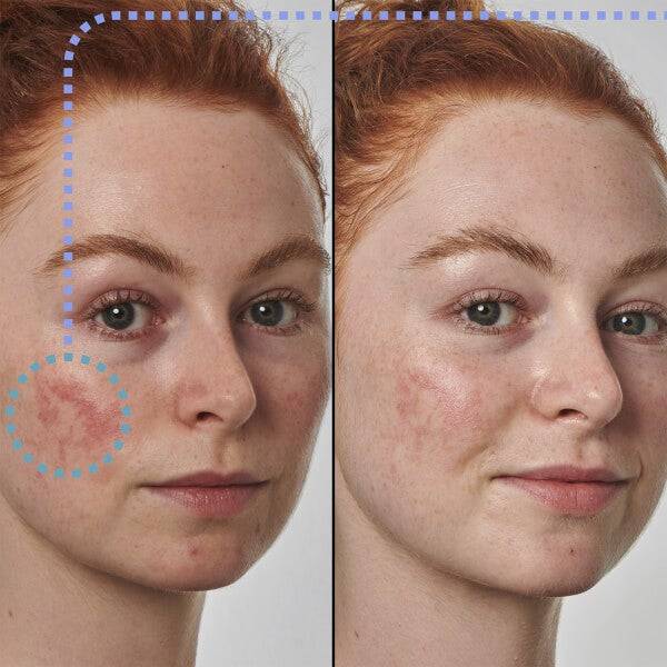 The INKEY List Super Solutions 10% Azelaic Acid Serum 30ml Neueste Mode
