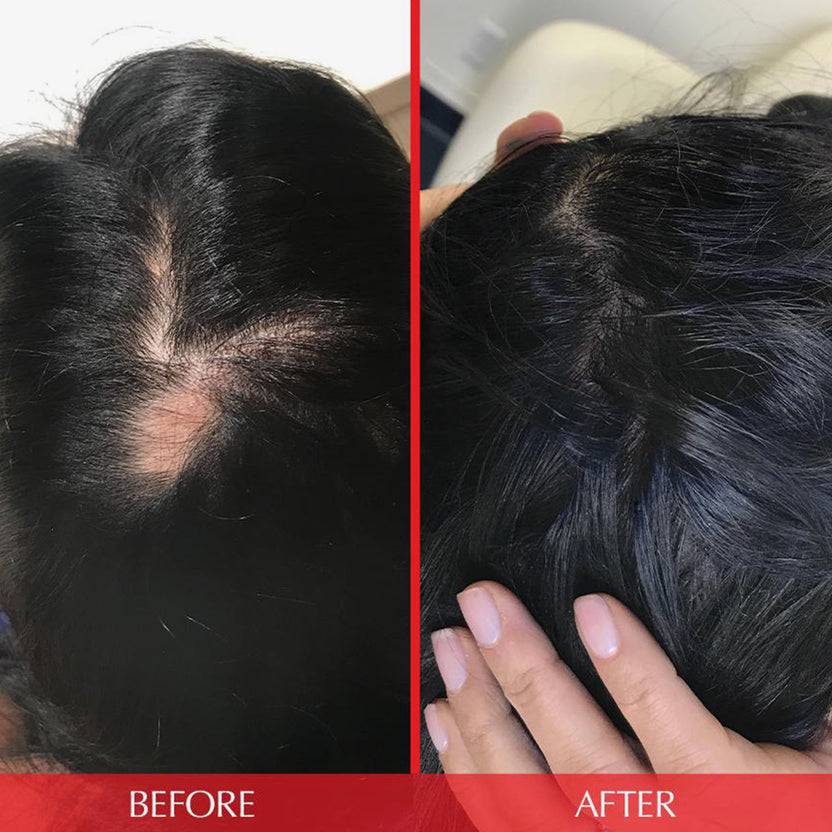 HAIRtamin HAIRtamin Advanced Formula 1 Month Meist gekauft