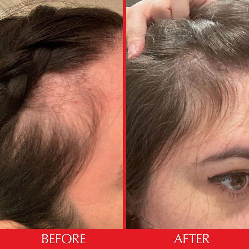 HAIRtamin Gummy Stars™ 1 Month Große Rabatte