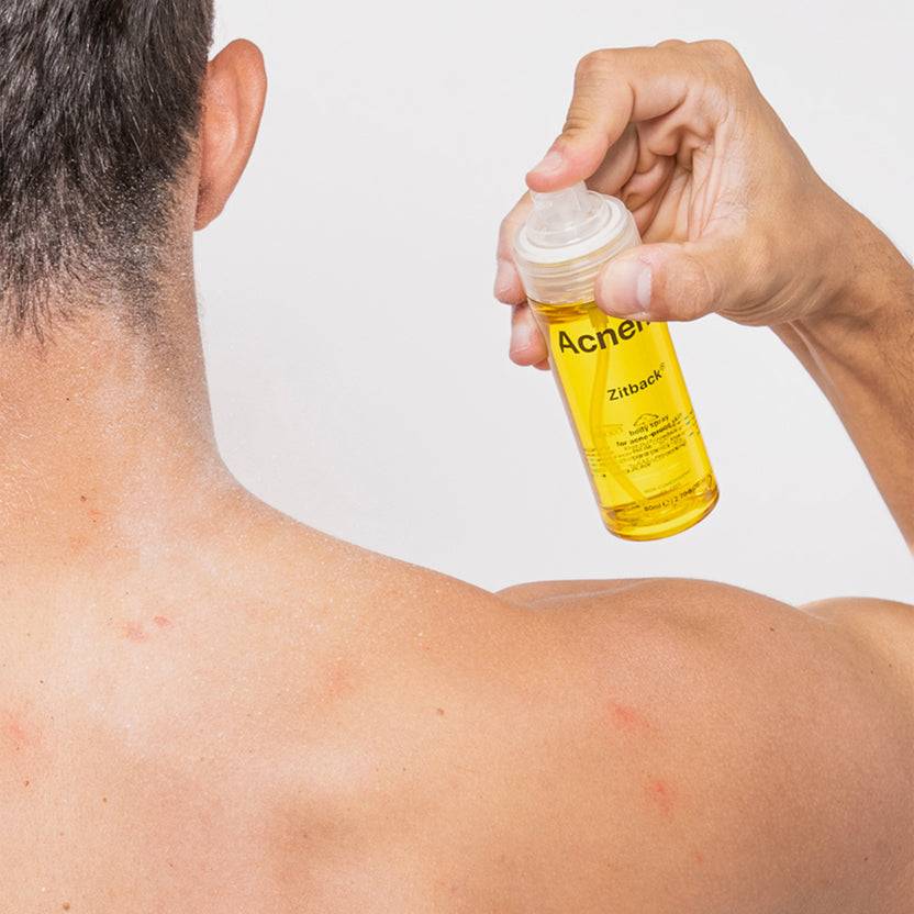 Acnemy Zitback® (80ml) Online