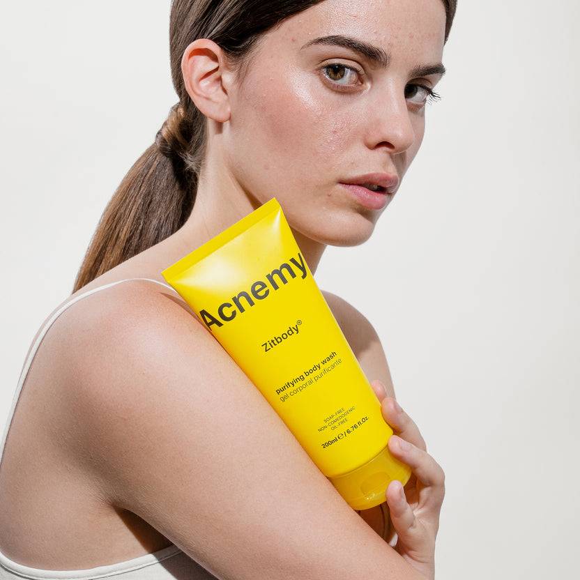 Acnemy Zitbody (200ml) Angebote