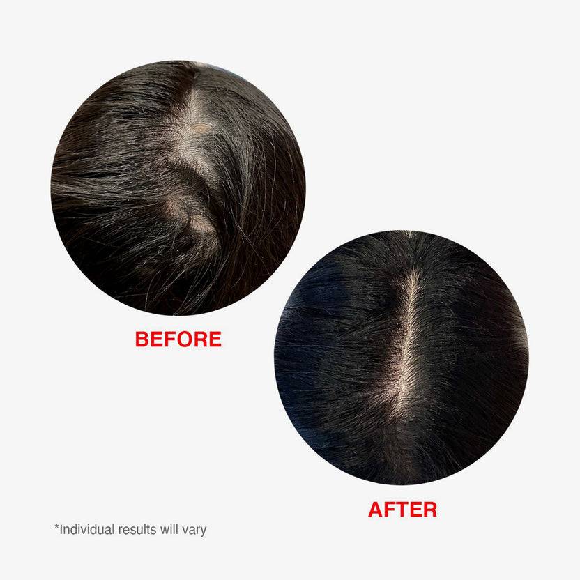 HAIRtamin Scalp Serum (60ml) Rabatt