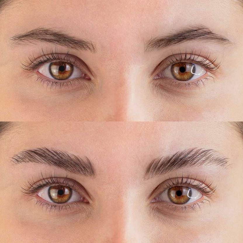 fleeky Browlift Kit Mini Kostenloser Versand
