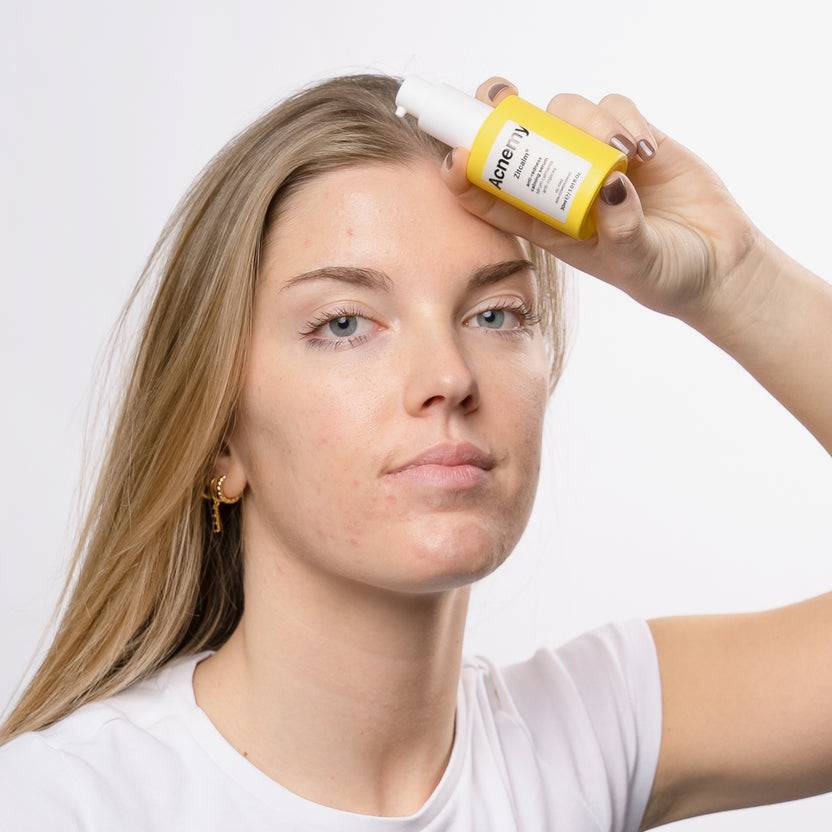 Acnemy Zitcalm Serum (30ml) Nur noch ein Tag übrig