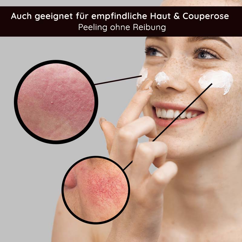 Rau Cosmetics Fruit Acid Peeling 100 ml Fruchtsäurepeeling mit BHA Bis zu 65% Rabatt